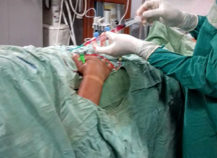 Distal radial access for routine consideration in coronary angiography-safety and feasibility study