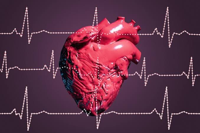 Drug-Induced Long QT: Case Report