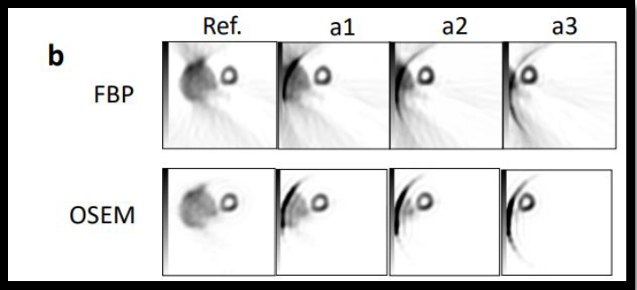 Prerequisite for projection data and reconstruction not to cause truncation artifacts in myocardial perfusion single- photon emission computed tomography: Phantom study