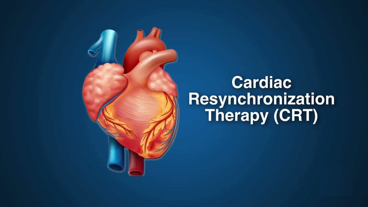 Impact of QRS Duration Limits on Cardiac Resynchronization Therapy in Heart Failure Patients: A Retrospective Cohort Study